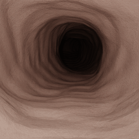 Bronchoscopy navigation