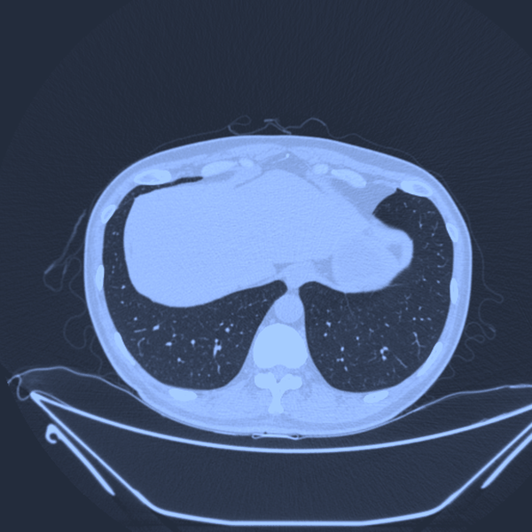 CT scan volume sweep