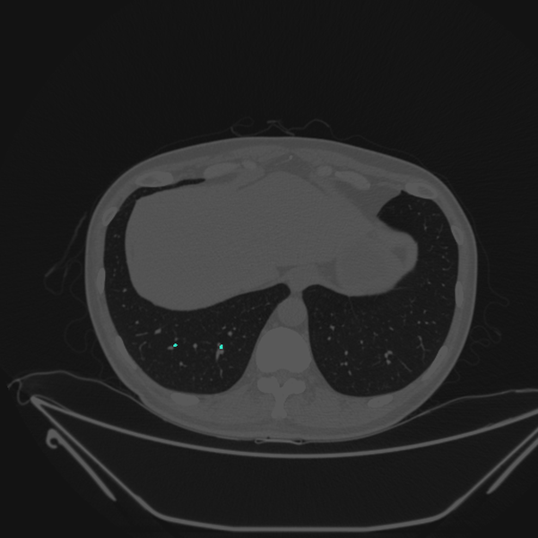 Airway segmentation sweep