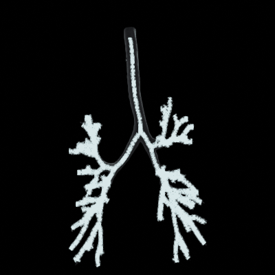 Skeleton spinning